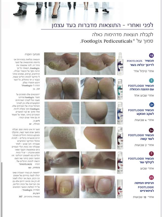 פוטלוגיקס מרכך יבלות  מספר 18 FootLogix מכיל 3.78 ליטר