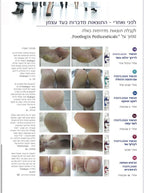 פוטלוגיקס מרכך יבלות  מספר 18 FootLogix מכיל 946 מ"ל