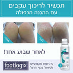 פוטלוג׳יקס קרם מוס לכף הרגל עם ההגנה הכפולה מספר 1 -FootLogix מכיל 125 מ"ל