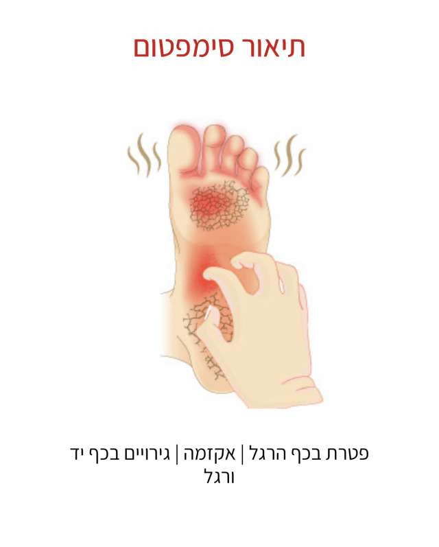 קרם אקטיבי לטיפול מהיר ויעיל באקזמה ופטרת העור בכף היד והרגל.