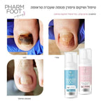 נוזל קולוסטרום לשיקום הציפורן לטיפול באוניכוליזיס פארם פוט onyPLASMA PHARM FOOT מכיל 15 מ"ל