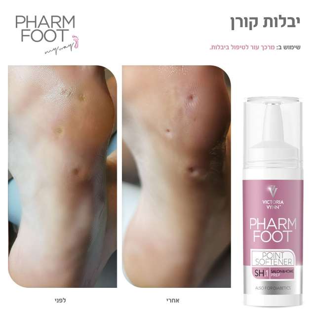 מרכך עור לטיפול בציפורן חודרנית וביבלות קאלוס פארם פוט POINT SOFTENER FHARM FOOT מכיל 15 מ"ל
