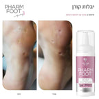 מרכך עור לטיפול בציפורן חודרנית וביבלות קאלוס פארם פוט POINT SOFTENER FHARM FOOT מכיל 15 מ"ל