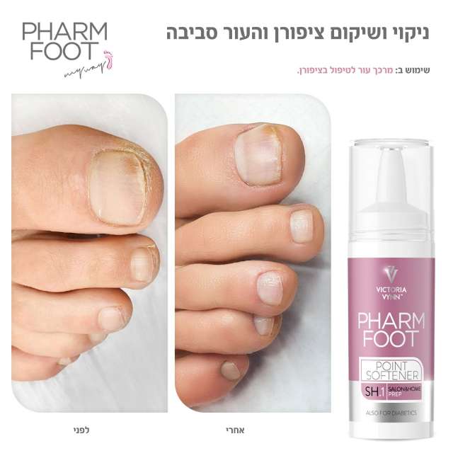 מרכך עור לטיפול בציפורן חודרנית וביבלות קאלוס פארם פוט POINT SOFTENER FHARM FOOT מכיל 15 מ"ל