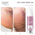 קצף להסרת קאלוס 30% אוריאה פארם פוט ANTI CALLUS MASTER FHARM FOOT מכיל 200 מ"ל