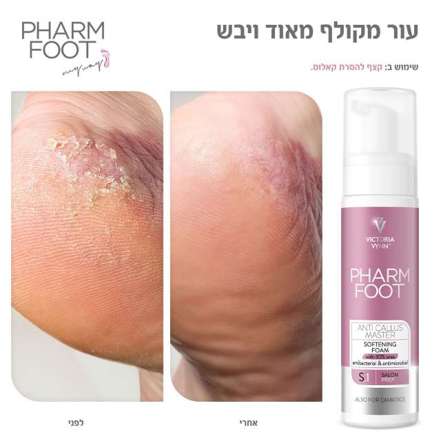 קצף להסרת קאלוס 30% אוריאה פארם פוט ANTI CALLUS MASTER FHARM FOOT מכיל 200 מ"ל