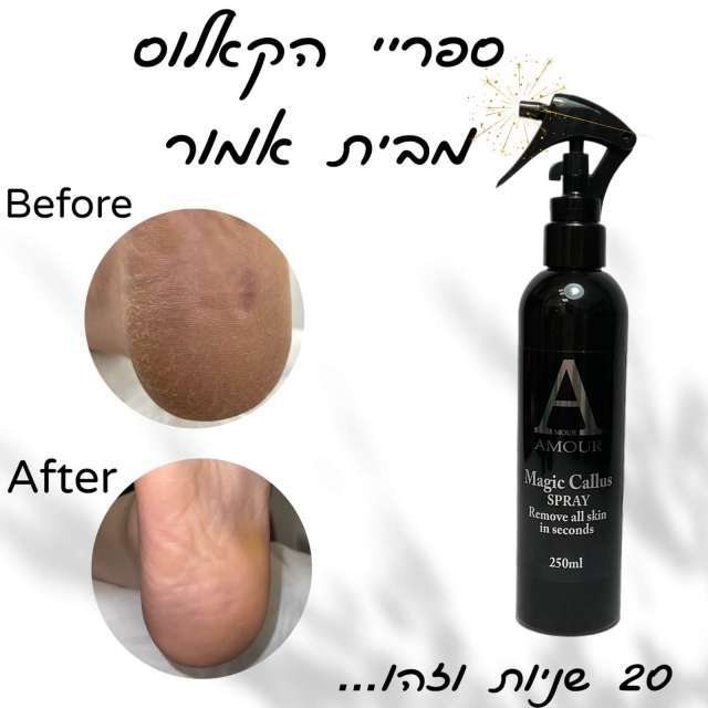 ספריי קאלוס מגיק ספריי קאלוס ללא צורך במים מסיר תוך 20 שניות עור קשה -אמור AMOUR מכיל 250 מ"ל